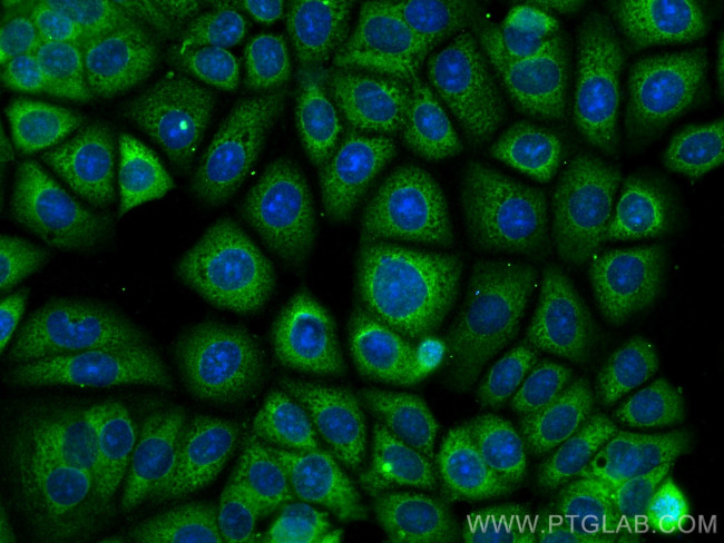 EIF2B5 Antibody in Immunocytochemistry (ICC/IF)