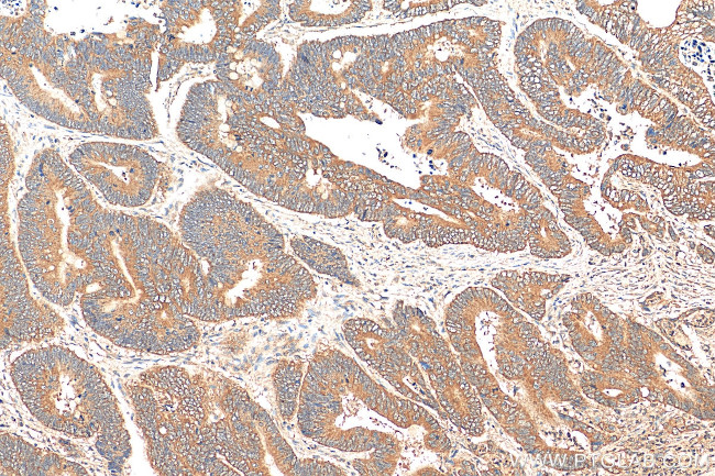 EIF2B5 Antibody in Immunohistochemistry (Paraffin) (IHC (P))