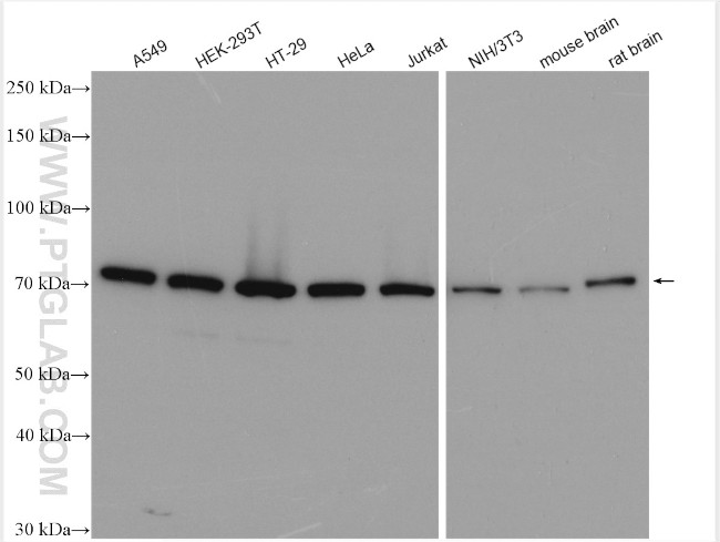 EIF2B5 Antibody in Western Blot (WB)