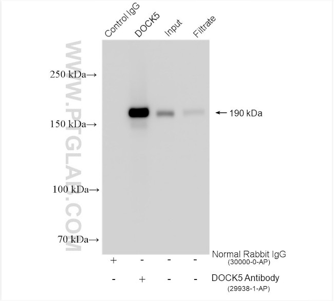 DOCK5 Antibody in Immunoprecipitation (IP)