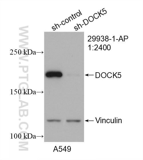 DOCK5 Antibody in Western Blot (WB)