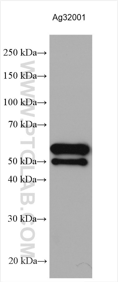T7 RNA polymerase Antibody in Western Blot (WB)