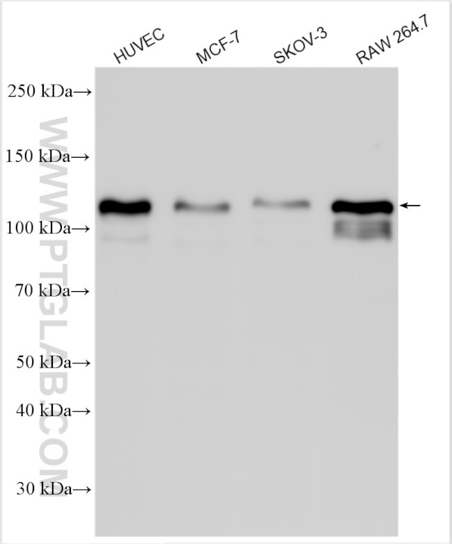 ADAM17 Antibody in Western Blot (WB)