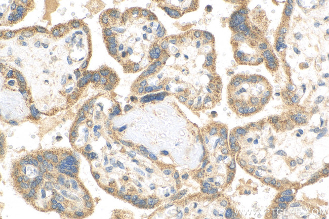 cGAS Antibody in Immunohistochemistry (Paraffin) (IHC (P))