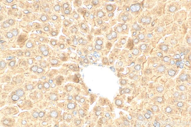 GAA Antibody in Immunohistochemistry (Paraffin) (IHC (P))