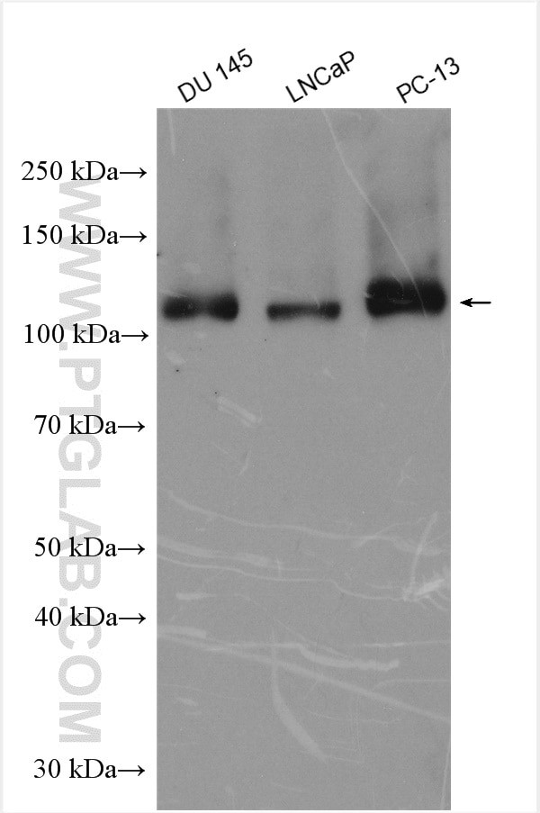 GAA Antibody in Western Blot (WB)