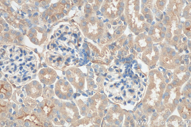 IDUA Antibody in Immunohistochemistry (Paraffin) (IHC (P))