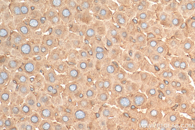 GPC3 Antibody in Immunohistochemistry (Paraffin) (IHC (P))