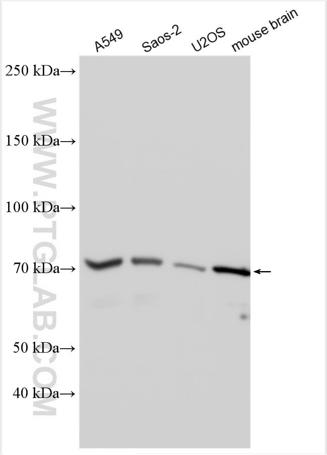 HIP14/ZDHHC17 Antibody in Western Blot (WB)