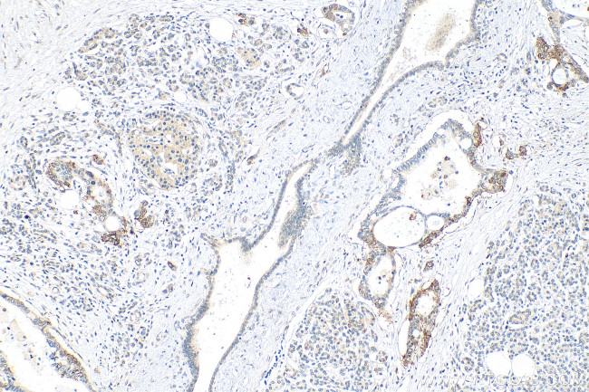 RBPJ Antibody in Immunohistochemistry (Paraffin) (IHC (P))