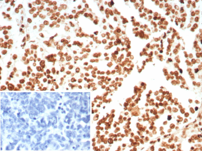 Histone H1 (Pan Nuclear Marker) Antibody in Immunohistochemistry (Paraffin) (IHC (P))