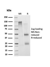 Histone H1 (Pan Nuclear Marker) Antibody in SDS-PAGE (SDS-PAGE)