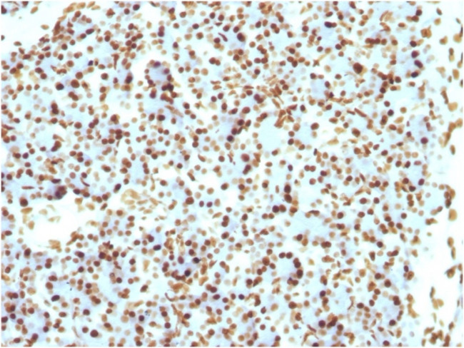 Histone H1 Antibody in Immunohistochemistry (Paraffin) (IHC (P))