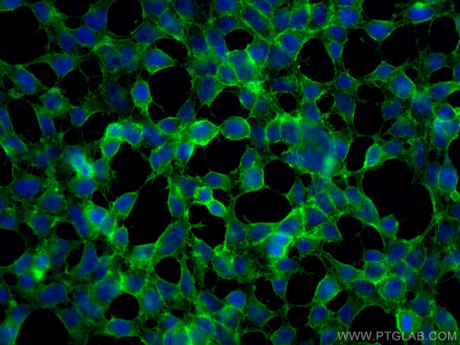 B7-H3 Antibody in Immunocytochemistry (ICC/IF)