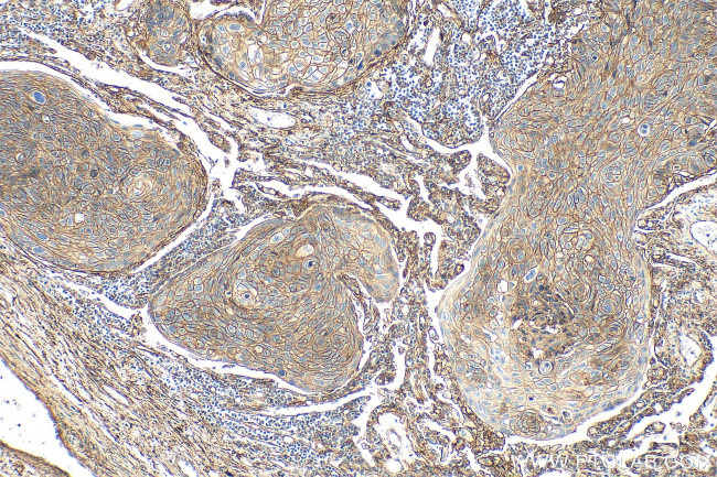 B7-H3 Antibody in Immunohistochemistry (Paraffin) (IHC (P))