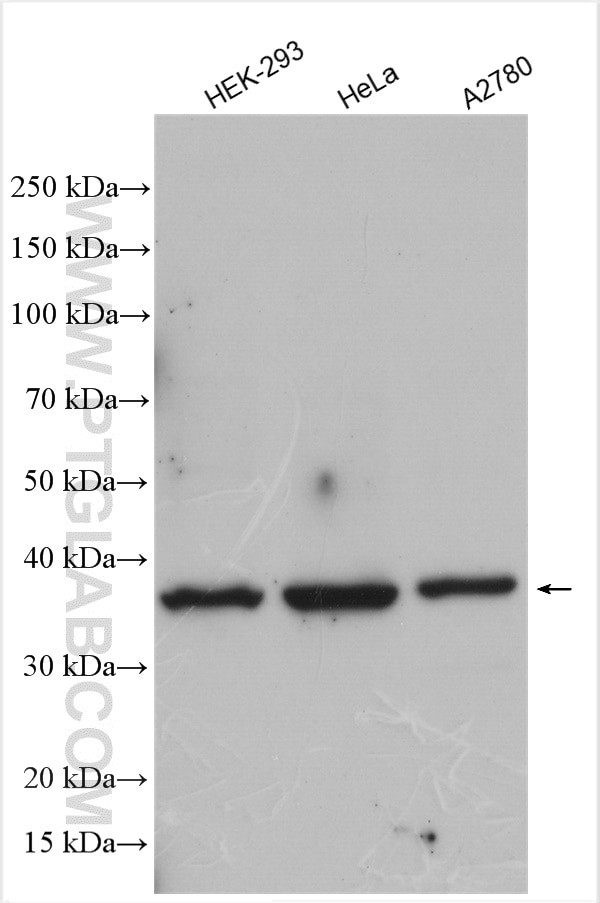 Rad51D Antibody in Western Blot (WB)