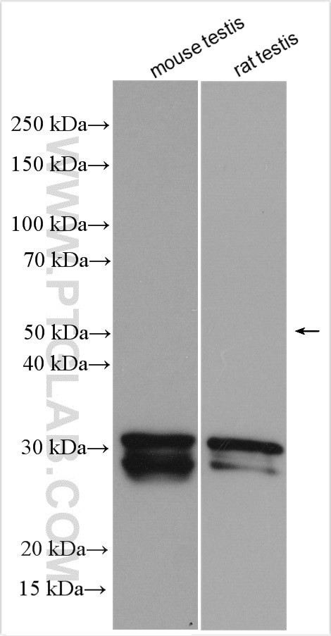 SYCP3 Antibody in Western Blot (WB)