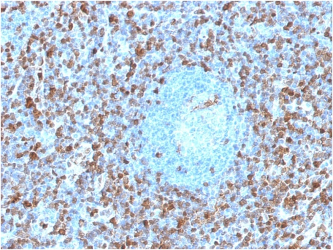 Annexin A1 Antibody in Immunohistochemistry (Paraffin) (IHC (P))