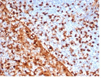 Annexin A1/ (Hairy Cell Leukemia Marker) Antibody in Immunohistochemistry (Paraffin) (IHC (P))