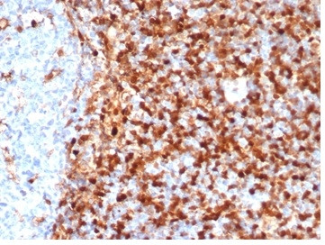 Annexin A1/(Hairy Cell Leukemia Marker) Antibody in Immunohistochemistry (Paraffin) (IHC (P))