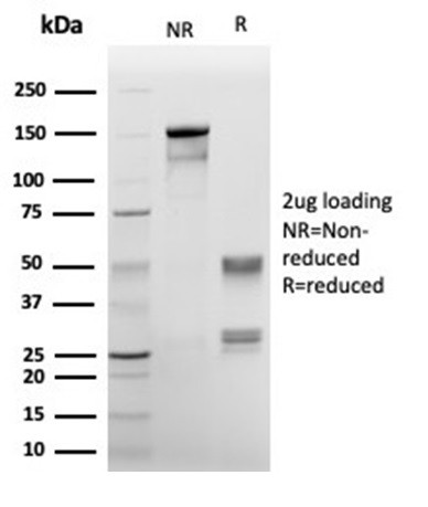 Annexin A1/ (Hairy Cell Leukemia Marker) Antibody in SDS-PAGE (SDS-PAGE)