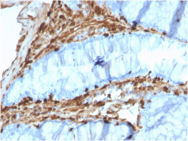 Annexin A1/ (Hairy Cell Leukemia Marker) Antibody in Immunohistochemistry (Paraffin) (IHC (P))