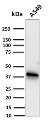 Annexin A1/ (Hairy Cell Leukemia Marker) Antibody in Western Blot (WB)