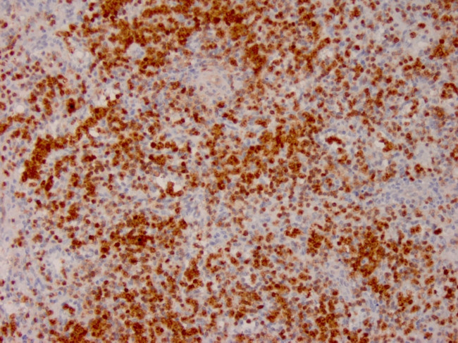 Annexin A1 Antibody in Immunohistochemistry (Paraffin) (IHC (P))