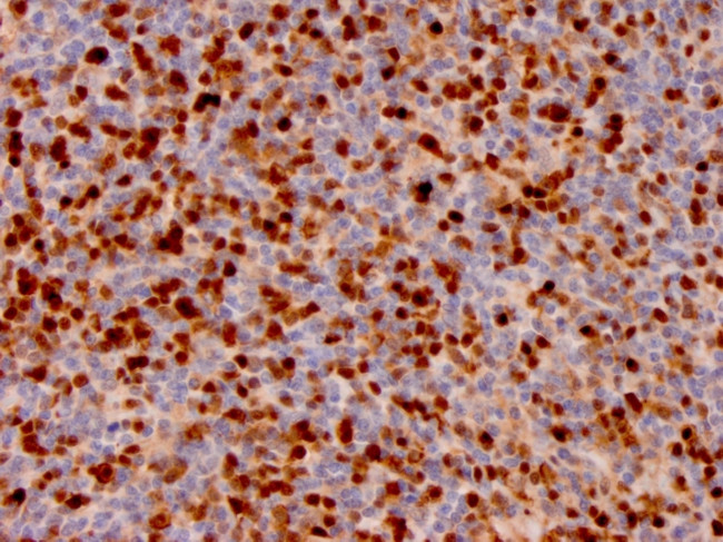 Annexin A1 Antibody in Immunohistochemistry (Paraffin) (IHC (P))