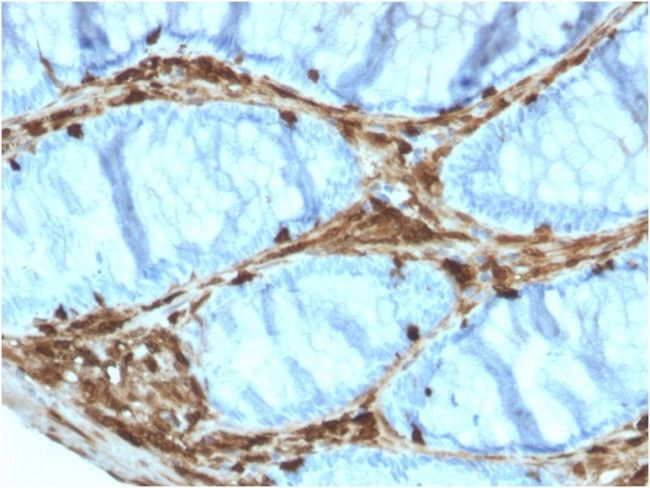 Annexin A1 Antibody in Immunohistochemistry (Paraffin) (IHC (P))