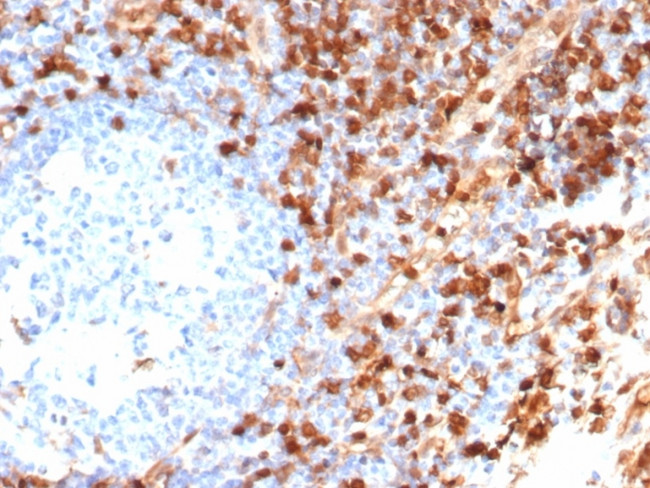 Annexin A1/(Hairy Cell Leukemia Marker) Antibody in Immunohistochemistry (Paraffin) (IHC (P))