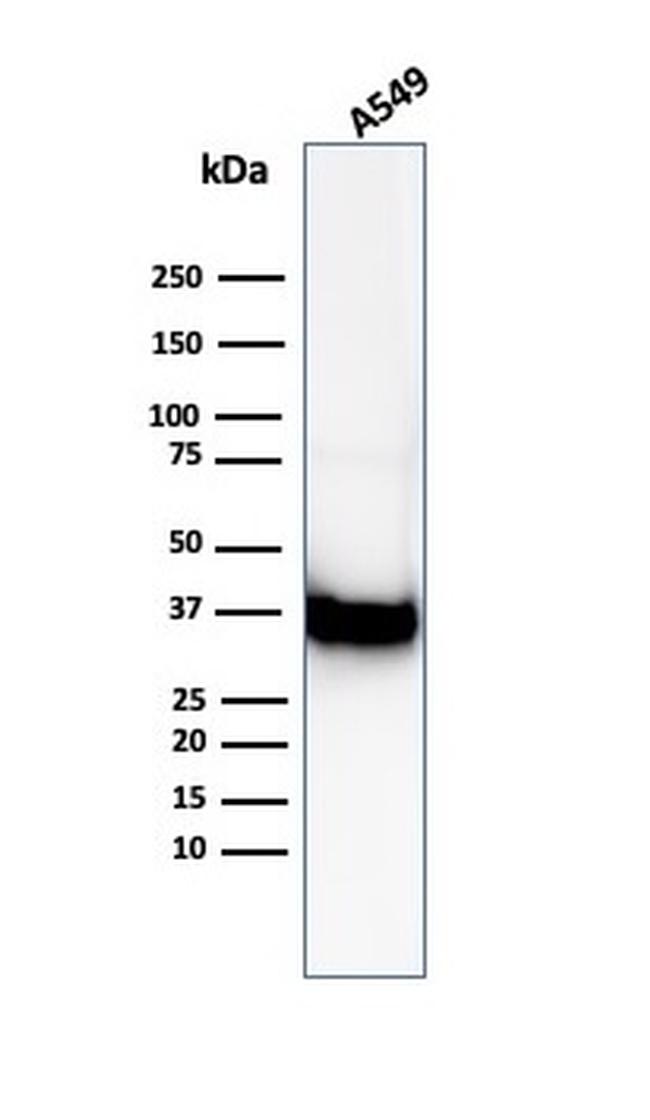 Annexin A1/(Hairy Cell Leukemia Marker) Antibody in Western Blot (WB)