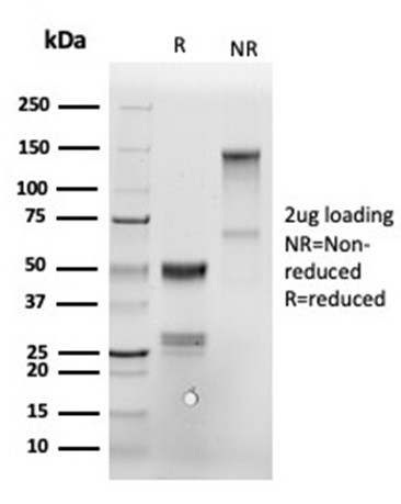 Annexin A1/ (Hairy Cell Leukemia Marker) Antibody in SDS-PAGE (SDS-PAGE)