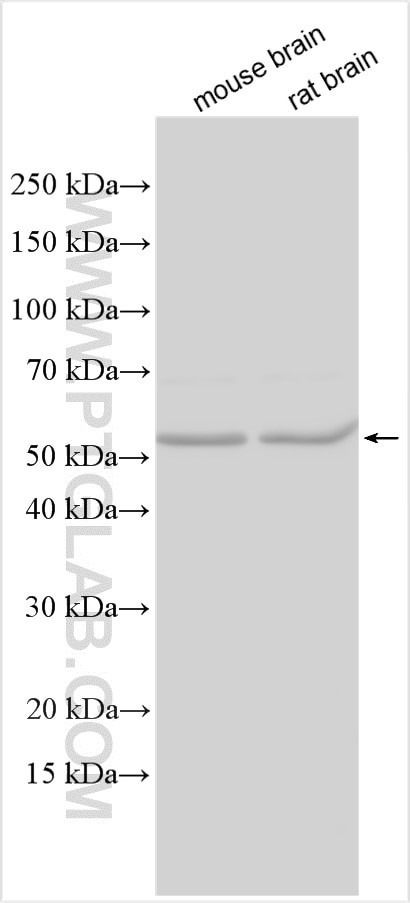 MMP24 Antibody in Western Blot (WB)