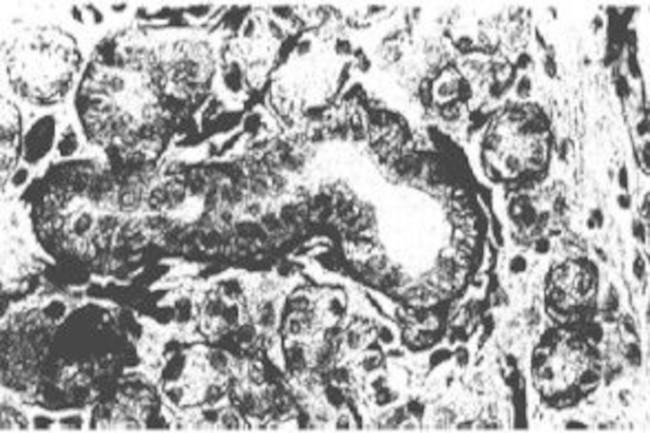 FGF Receptor 1 Antibody in Immunohistochemistry (Paraffin) (IHC (P))