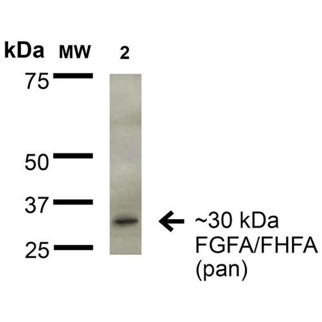 Fibroblast Growth Factor 13 (FGF13) Antibody in Western Blot (WB)