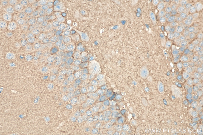 SEPT3 Antibody in Immunohistochemistry (Paraffin) (IHC (P))