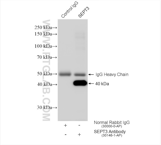 SEPT3 Antibody in Immunoprecipitation (IP)