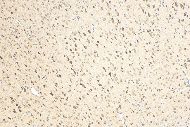 ADCY5 Antibody in Immunohistochemistry (Paraffin) (IHC (P))