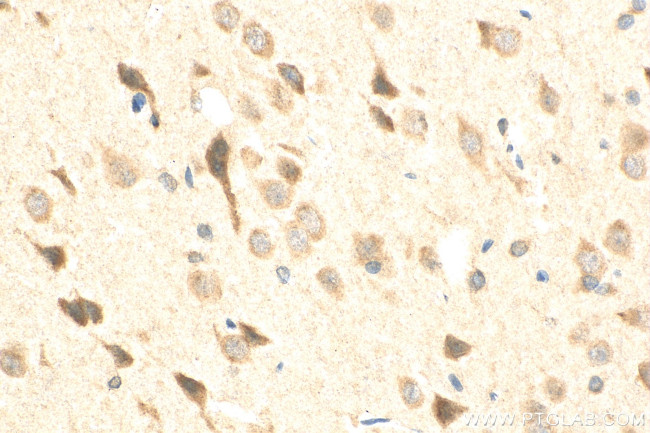 ADCY5 Antibody in Immunohistochemistry (Paraffin) (IHC (P))