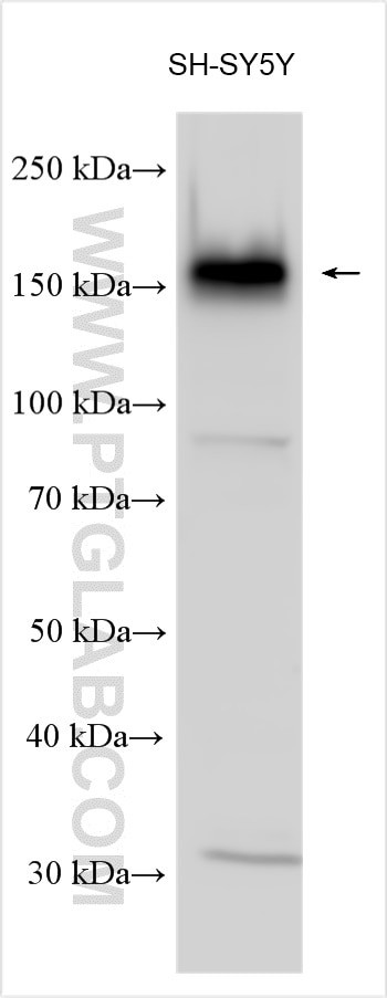 ADCY8 Antibody in Western Blot (WB)