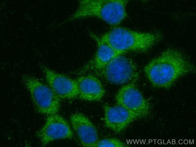 PACS2 Antibody in Immunocytochemistry (ICC/IF)