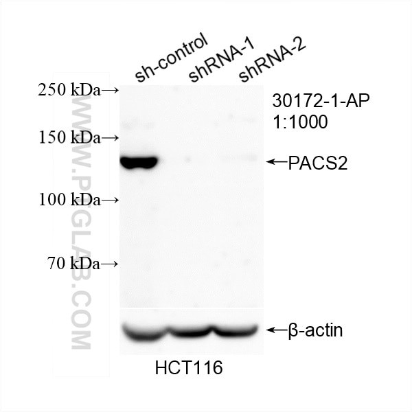 PACS2 Antibody in Western Blot (WB)