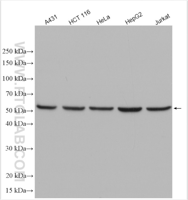 DDB2 Antibody in Western Blot (WB)