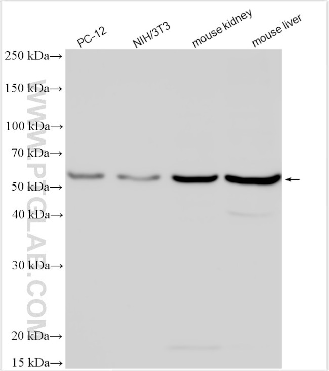 DDB2 Antibody in Western Blot (WB)