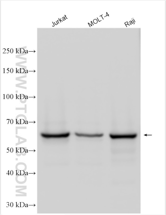 RASGRP2 Antibody in Western Blot (WB)