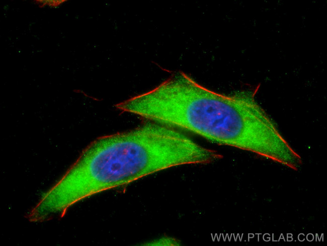 SHMT1 Antibody in Immunocytochemistry (ICC/IF)