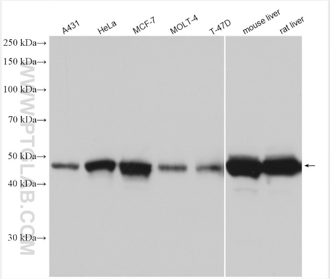 SHMT1 Antibody in Western Blot (WB)