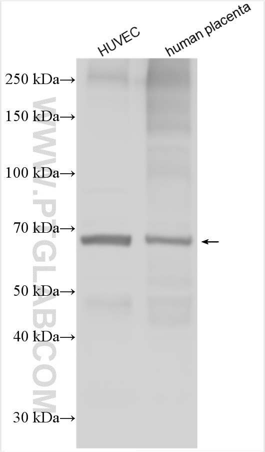 ST2 Antibody in Western Blot (WB)