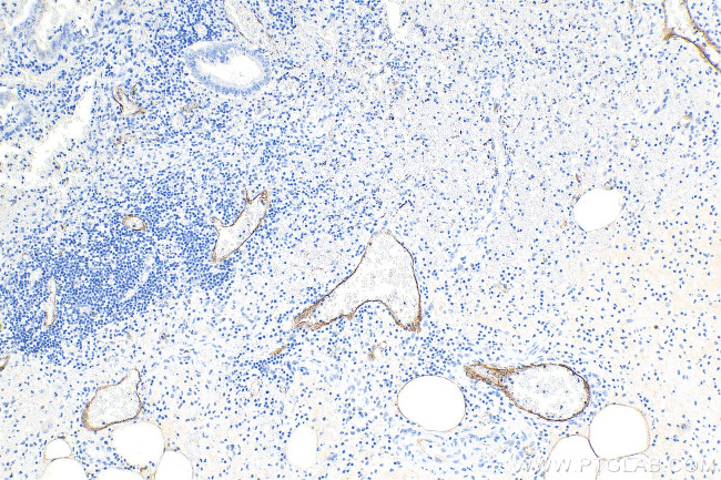 E-selectin/CD62E Antibody in Immunohistochemistry (Paraffin) (IHC (P))